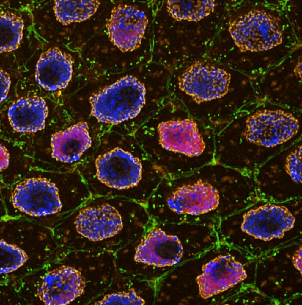 Image of cells from confocal microscope