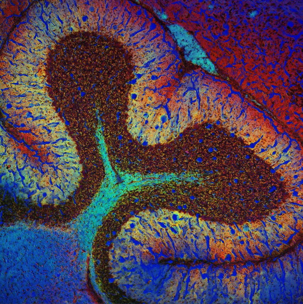 Microscopic image of brain